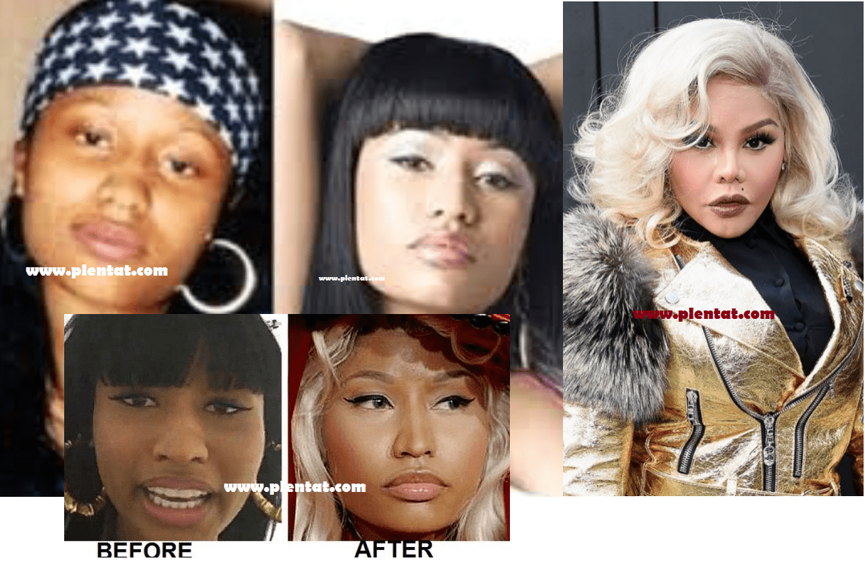 Nicki Minaj Before Plastic Surgery(Rapper, Singer, Writer ...