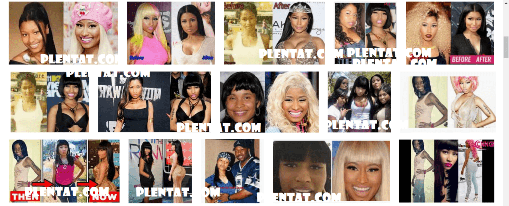 nicki minaj Before Plastic Surgery After