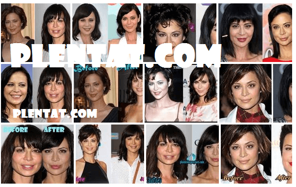 Catherine Bell Plastic Surgery Before And After