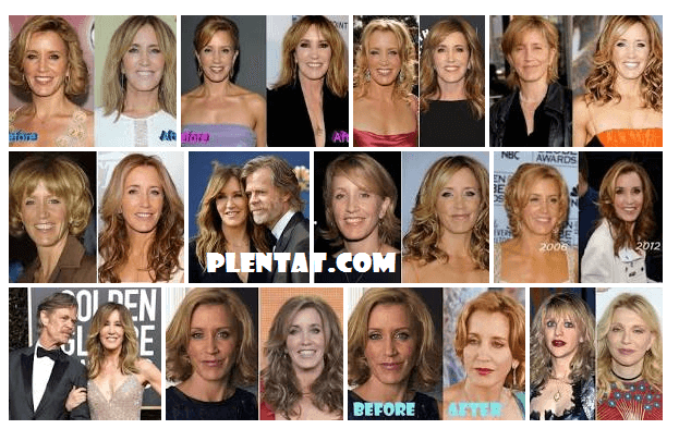 Felicity Huffman Plastic Surgery Before And After ( American Film Actress) (1)