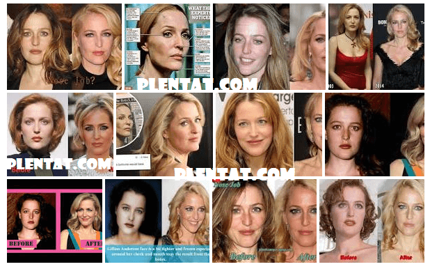 Gillian Anderson Plastic Surgery Before And After (1)