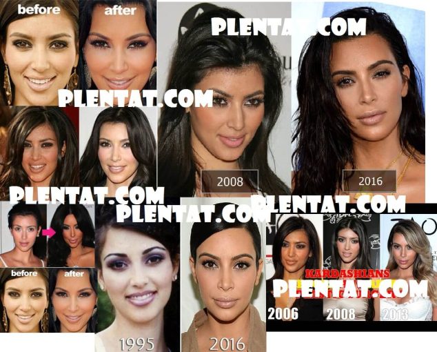Kim Kardashian Before Plastic Surgery