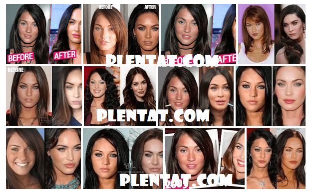 Megan Fox Plastic Surgery Before And After