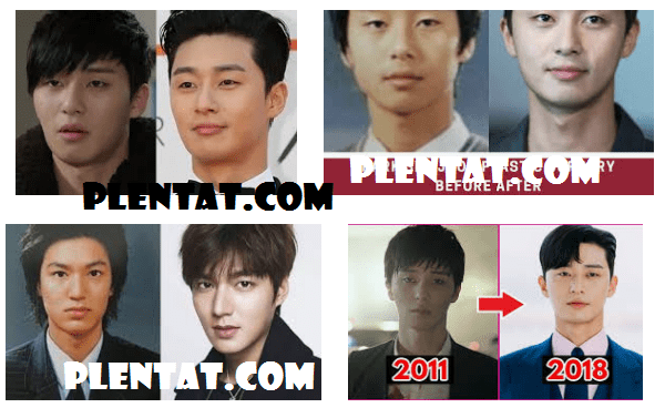 Park Seo Joon Plastic Surgery Before And After