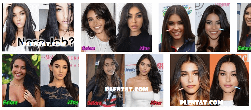 madison beer before and after