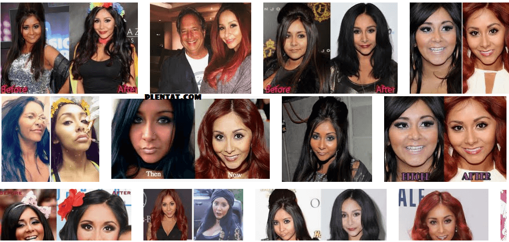 Snooki Plastic Surgery Before And After (Nicole Polizzi Television Personality)