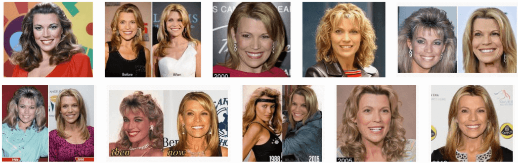 Vanna White Plastic Surgery Before And After (American ...