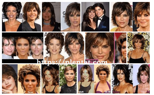 Lisa Rinna Plastic Surgery Before And After