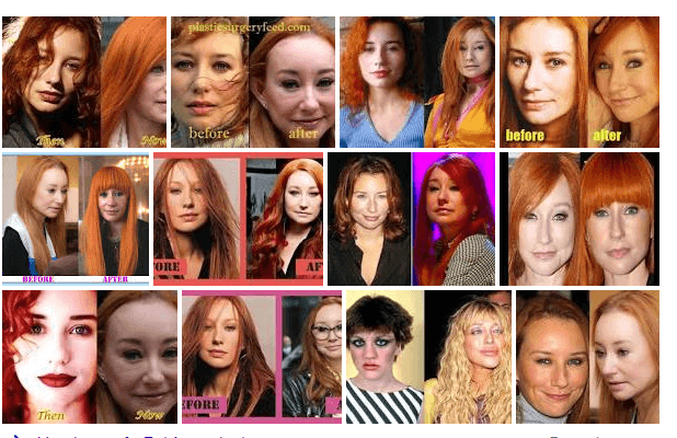 Tori Amos Plastic Surgery Before And After (American Singer-Songwriter)