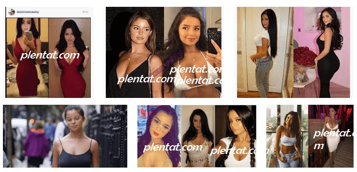 Demi Rose Plastic Surgery Before And After.