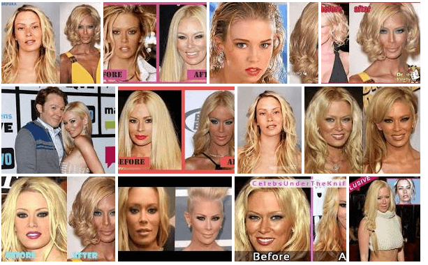 Jenna Jameson Before Plastic Surgery