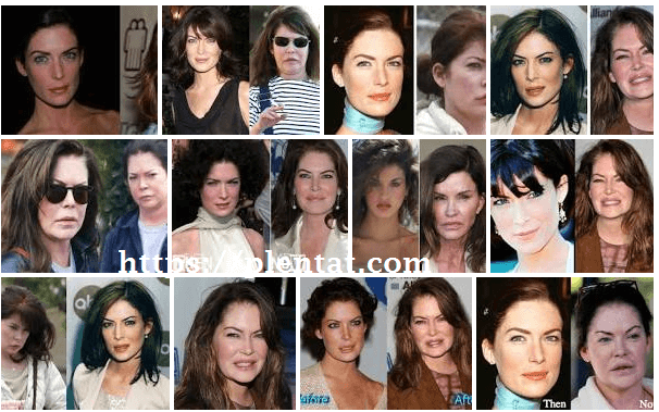 Lara Flynn Boyle Before Plastic Surgery And Looks After Surgery