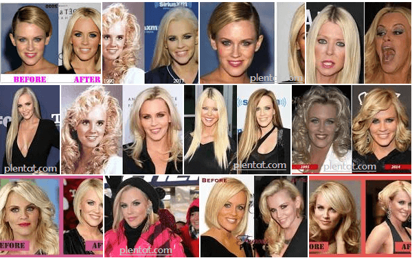 Jenny Mccarthy Before Plastic Surgery After Nose Job Face Lift