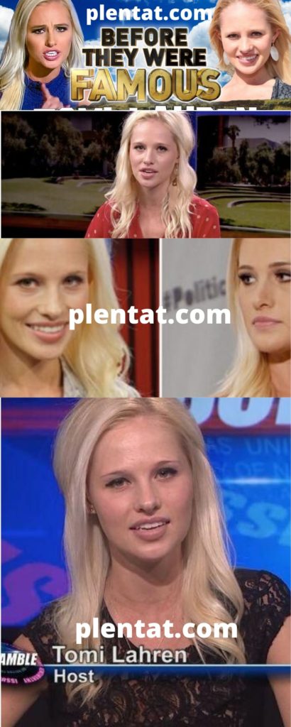 Tomi Lahren Before Plastic Surgery After Surgery Real